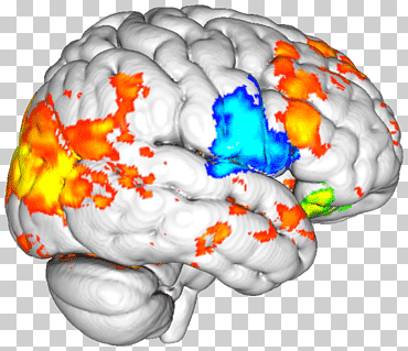universidad de boston universidad de delaware cerebro de la universidad de binghamton, Universidad, mapa, cerebro en reposo png