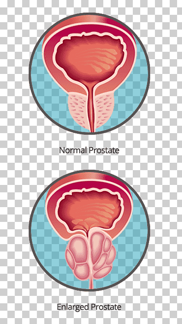 organismo diseño, cuerpo humano, próstata, Art º png
